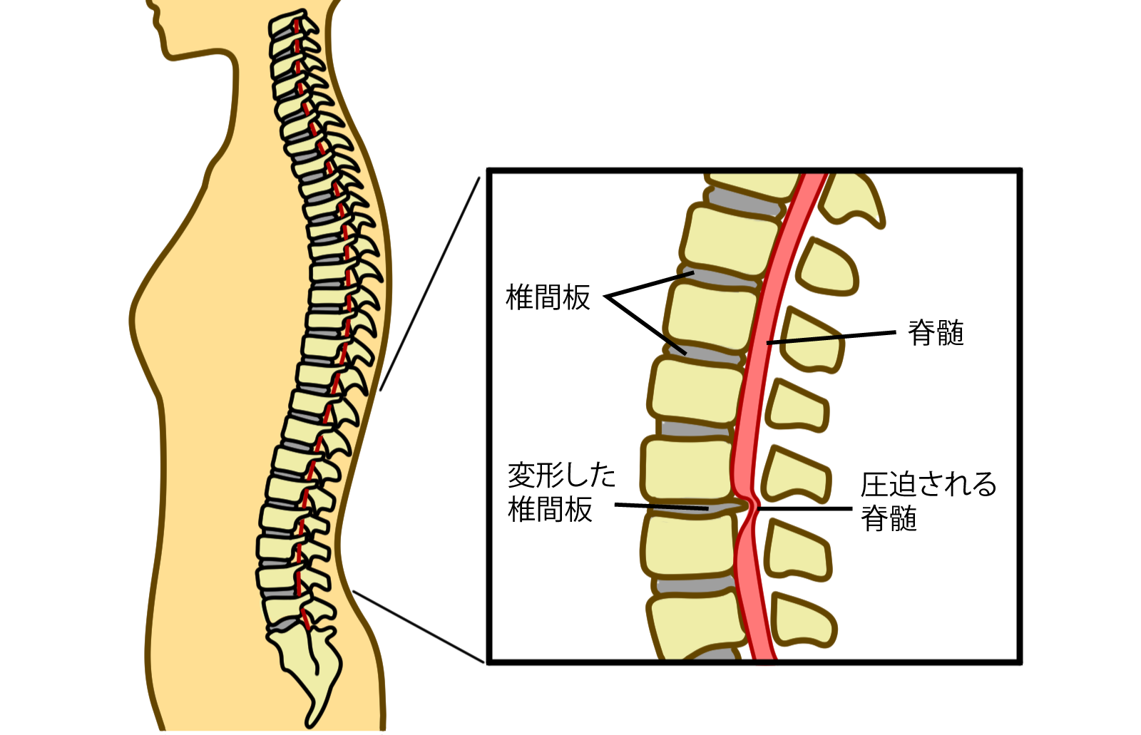 腰痛・坐骨神経痛 - 荻窪 痛み＆リハビリクリニック
